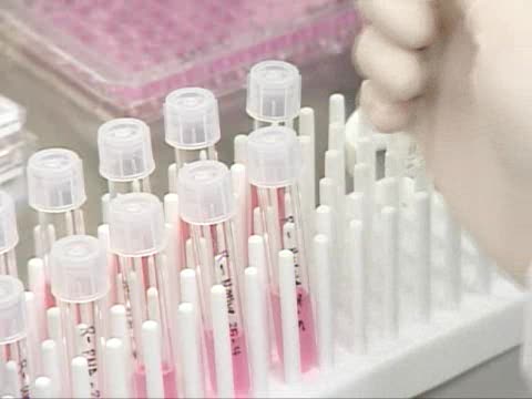 23-rd case of H1N1 confirmed in Georgia